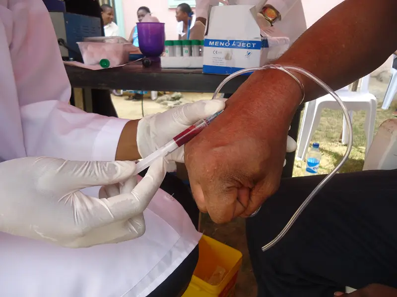 DBCO Retro Viral Screening